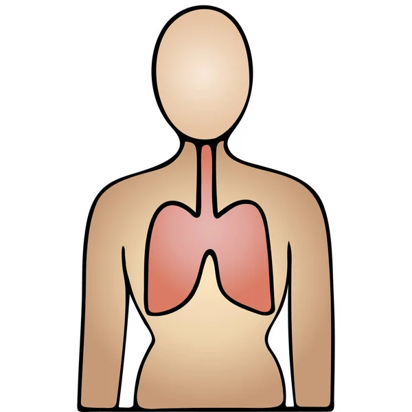 Pulmón Del Paciente Órgano Respiratorio Más Propenso Complicaciones Infección Por — Vector de stock