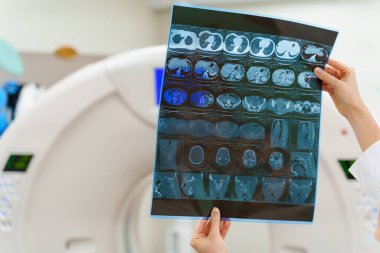 Bilgisayar tomografisinin enstrümantal araştırma diyagostik yöntemleri. Röntgen filmi ellerinde. Arkaplanda CT
