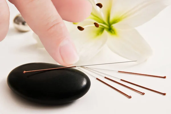 Akupunkturnadeln mit Lilie und Steinen Hintergrund — Stockfoto