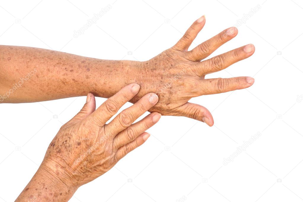 Female hands full of freckles