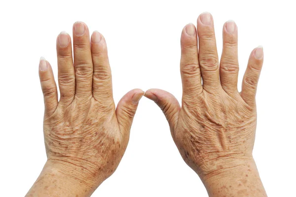 Mani della persona anziana — Foto Stock