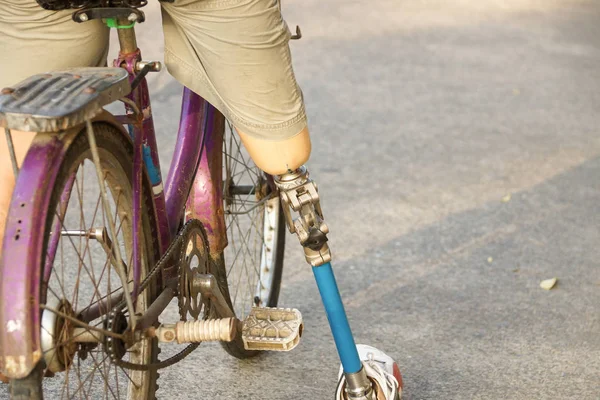 Amputato Bicicletta — Foto Stock