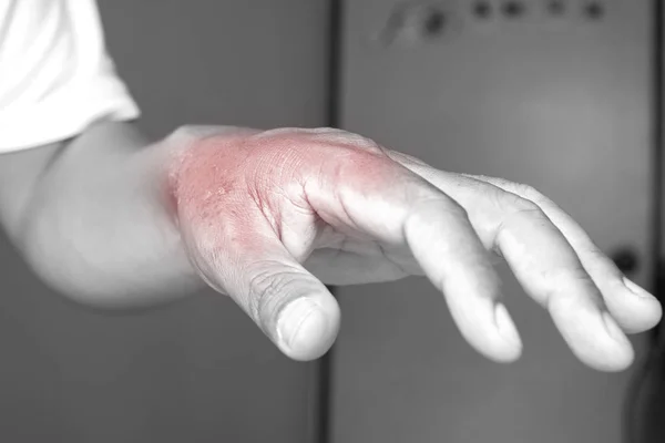 Itching of skin diseases in men using the hand-scratching. Red a