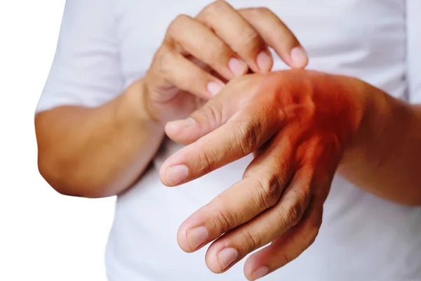 Comichão de doenças de pele em homens usando o arranhão da mão. Vermelho a — Fotografia de Stock