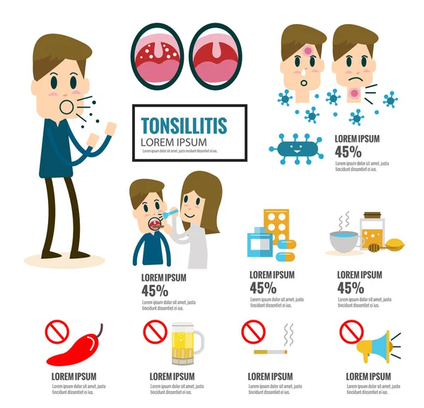 Tonsilite elemento infográfico. conceito de cuidados de saúde . — Vetor de Stock