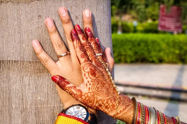 Man Och Kvinna Händer Med Deras Förlovning Ringer — Stockfoto