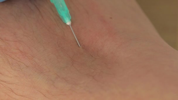 Close-up of a medical needle that sticks into a vein and takes a blood test. — Stock Video