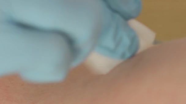 Acercamiento de una aguja médica que se pega en una vena y se hace un análisis de sangre . — Vídeos de Stock