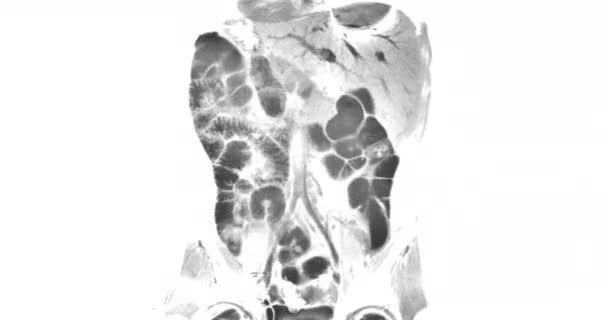 Body Scan Risonanza Magnetica Immagini Nucleo Sanitario — Video Stock