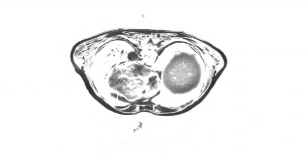 Resonancia Magnética Corporal Imágenes Por Resonancia Magnética Núcleo Salud — Vídeos de Stock