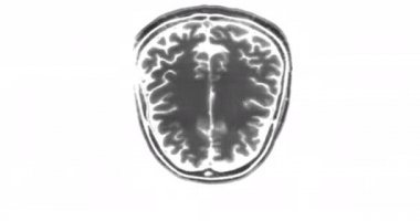 MRI taraması. Manyetik Rezonans Görüntüleme. Sağlık Çekirdeği