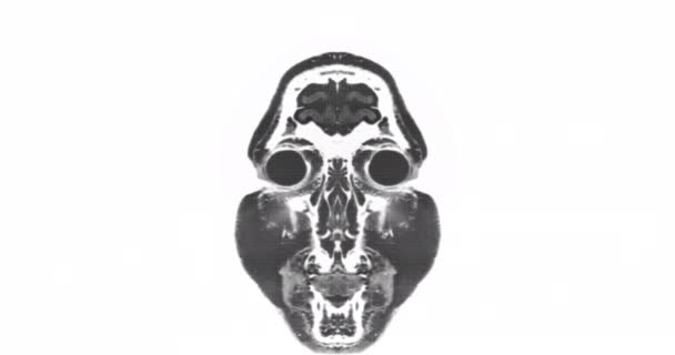 夫人身体扫描 磁共振成像技术 健康核子 — 图库视频影像