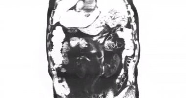 MRI taraması. Manyetik Rezonans Görüntüleme. Sağlık Çekirdeği
