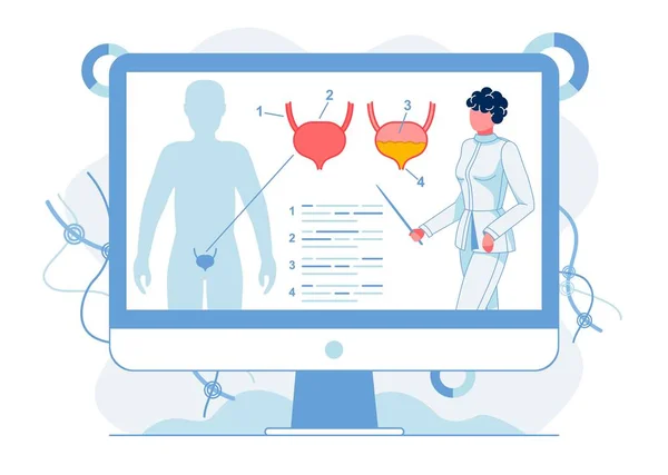 Studio dell'anatomia della vescica umana illustrazione piatta — Vettoriale Stock