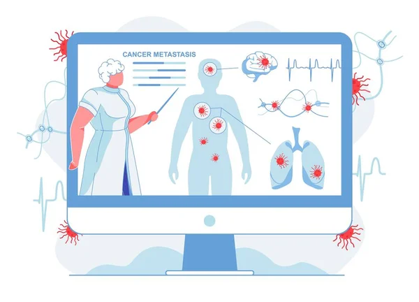 Doctor mostrando metástasis del cáncer Ilustración plana — Archivo Imágenes Vectoriales
