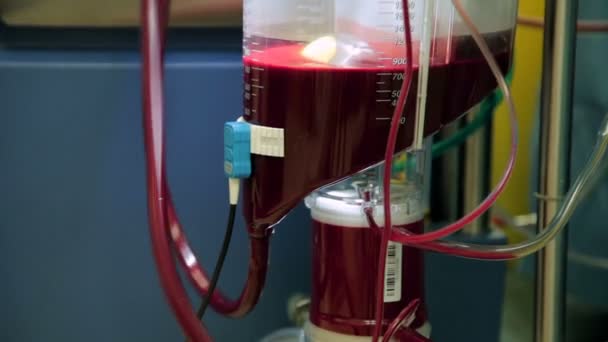 Primer plano de una máquina de corazón-pulmón en funcionamiento con un gran reservorio de sangre — Vídeo de stock