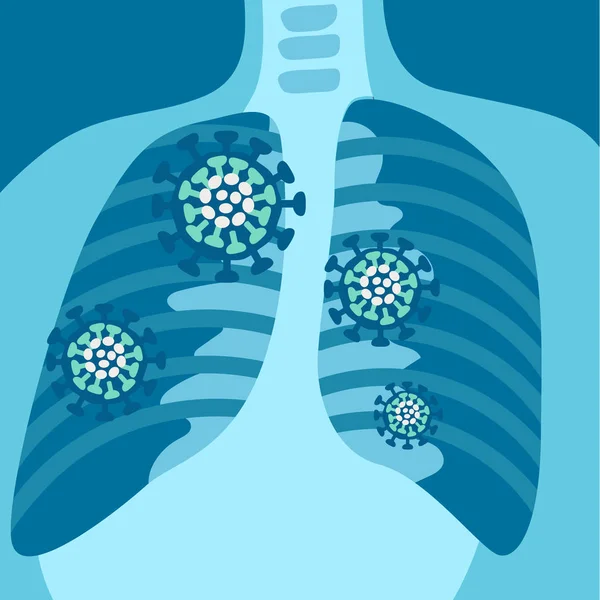Radiografía del sistema respiratorio con síntomas — Vector de stock