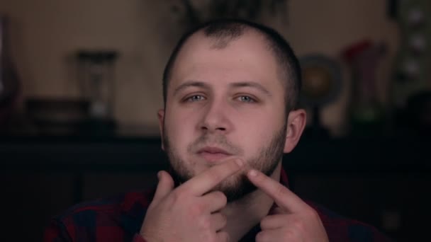 Ein junger Kerl europäischen Aussehens in karierter Hemd-Nahaufnahme drückt einen Pickel. akne. das Konzept der Emotionen — Stockvideo