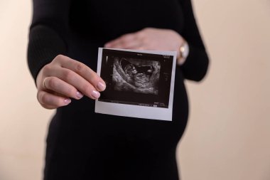 Cropped image of young pregnant woman holding ultrasound picture
