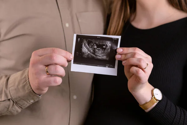 Gravidanza, donna incinta, piccolo tiro in mano, in attesa di una ch — Foto Stock