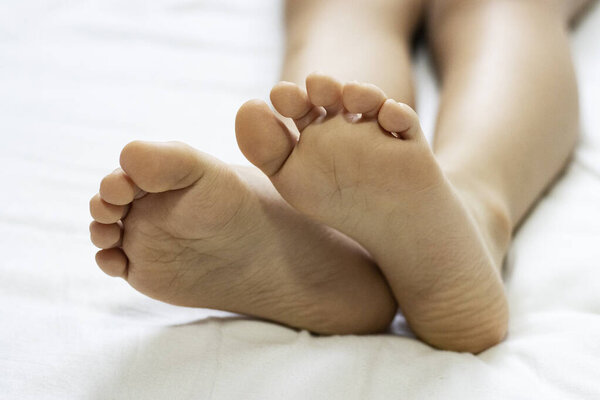 children's heels on a white bed close-up. feet of a child with flat feet lying in bed