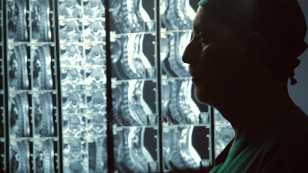 Ernstige mannelijke therapeut kijken Mri-scans, wrijven kin, ongeneeslijke ziekte — Stockvideo