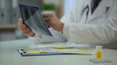 Hastanın akciğer röntgeni analiz ve tanı, tedavi yazma terapisti