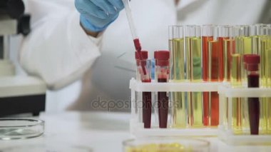 Klinik test, mikroskop altında kan örnekleri analiz laboratuvar bilim adamı