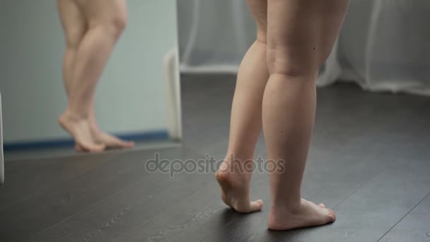 Ноги женщины с избыточным весом с плоскими ногами и целлюлитом, проблемы с ожирением — стоковое видео