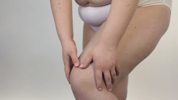 Skin problems of overweight woman, female in white lingerie posing for camera — Stock Video