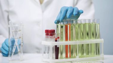 Tüp, biyomedikal araştırma laboratuvarında yapıyor kadın alarak doktorlar eller