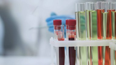 Tablo, HIV testi, mikrobiyolojik numuneler üzerinde duran kan örnekleri