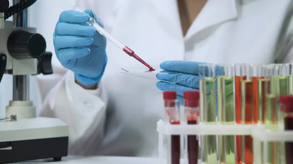 Biokémiai kutatás a vér, ennek mikrobiológiai vizsgálat labor asszisztens — Stock Fotó