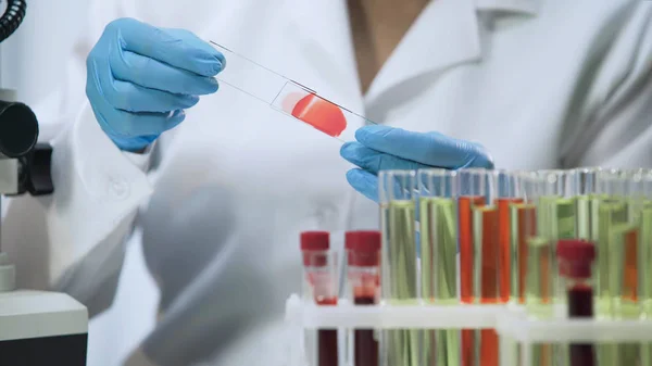 Practicante haciendo análisis bacteriológicos de sangre en laboratorio, primer plano — Foto de Stock