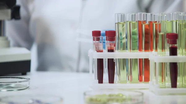 Κλινική δοκιμή, το αίμα και το εμβόλιο δείγματα στέκεται πάνω στο τραπέζι στο εργαστήριο — Φωτογραφία Αρχείου
