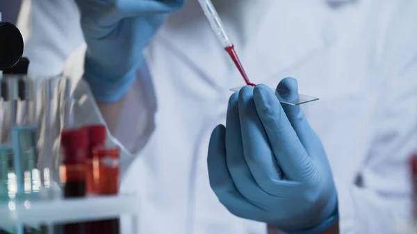 Laboratoriearbeider som tilbereder lysbilder med blodprøver og lager ny vaksine stockfoto