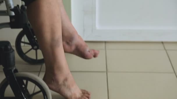 Primer plano sentado en silla de ruedas, lesión en las piernas, departamento de traumatología — Vídeos de Stock