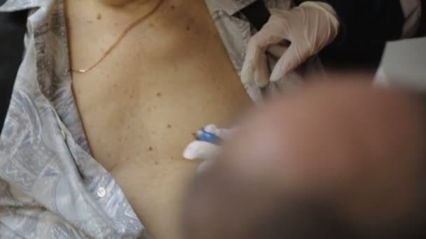 Sjukhus-teamet att göra brådskande kardiogram för mannen i första hjälpen bil, hjälp — Stockvideo