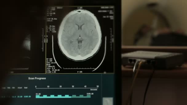 Результаты рентгена опухоли на экране с аппаратом МРТ сзади, компьютерная диагностика — стоковое видео