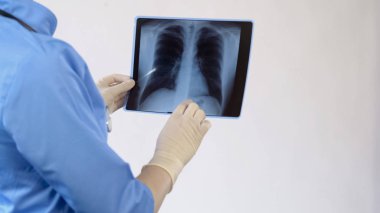 Doktor hasta akciğer röntgeni, bronş hastalığı tedavi, zatürre kontrol