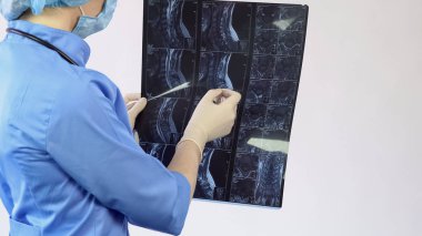Kadın Doktor hastanın Omurga kemikleri x-ray, sırt ağrısı tedavi, hastane analiz