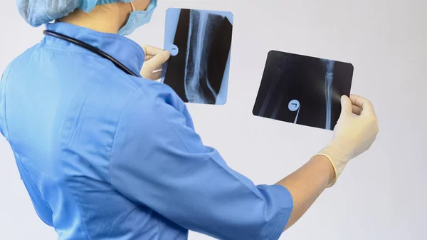 Traumatóloga profesional que mira la radiografía de huesos de pacientes, atención médica — Foto de Stock