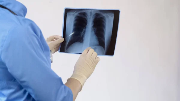 Médico que verifica os pulmões dos doentes raio-X, tratamento da doença brônquica, pneumonia — Fotografia de Stock