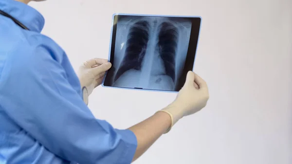 Terapeuta femenina analizando radiografía pulmonar, resultado del examen de la paciente, diagnóstico — Foto de Stock