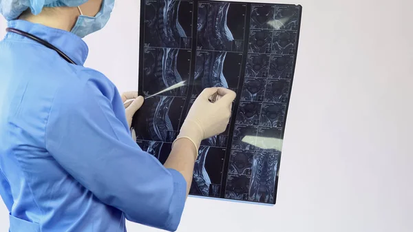 Médico mujer analizando paciente espina dorsal huesos rayos X, tratamiento de dolor de espalda, hospital —  Fotos de Stock