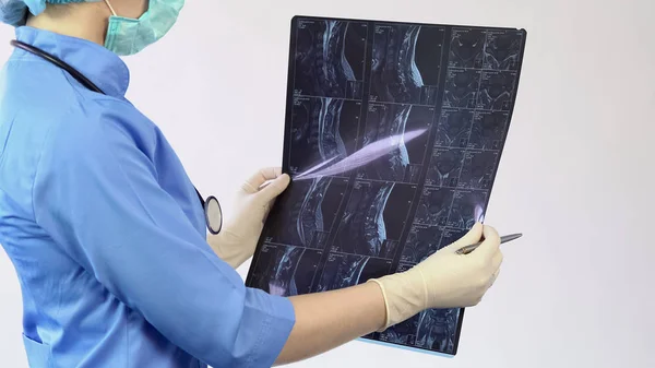 Mujer cirujana revisando paciente radiografía de cuello, tratamiento de lesiones óseas, diagnóstico — Foto de Stock