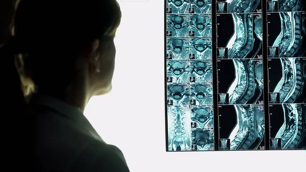 Женщина-врач смотрит на рентген рентгеновского снимка шеи пациента, диагностирует пациента — стоковое фото