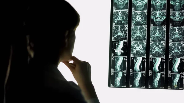 Arzt analysiert Patientenbild, diagnostiziert Rückenprobleme, Röntgen — Stockfoto