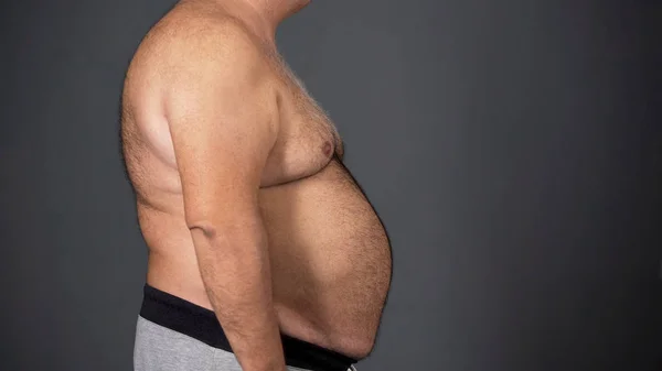 Homem insalubre com barriga gorda, resultado de dependência alimentar insalubre, problemas de saúde — Fotografia de Stock