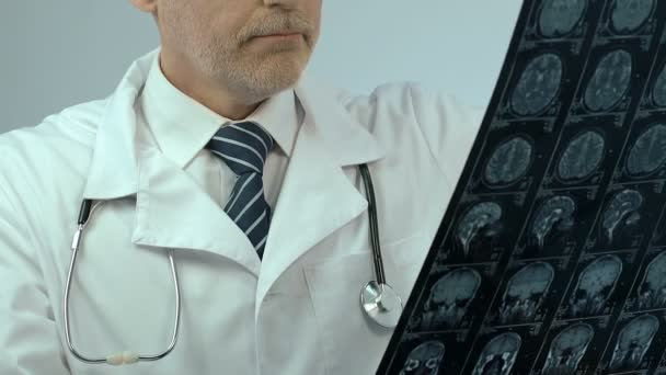 Χειρουργός Εξετάζει Κρανίο Εγκέφαλος Φιλμ Ακτίνων Δυσαρεστημένος Αποτελέσματα Τον Καρκίνο — Αρχείο Βίντεο